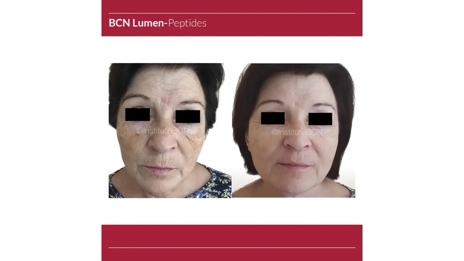 1-Advancing-Cosmetic-Treatments-with-Institute-BCN-Mesotherapy-Products-1536x864