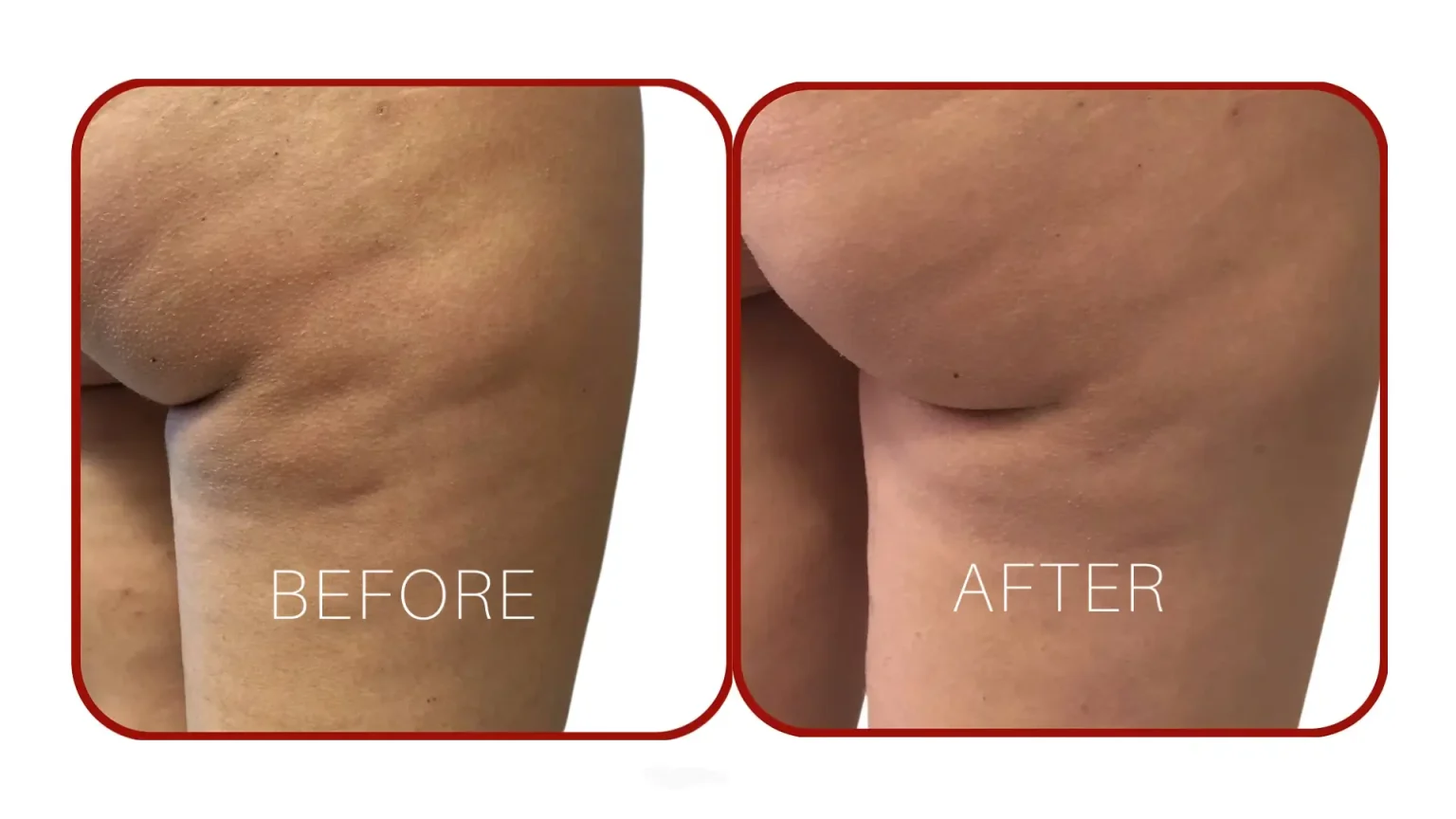1-Real-World-Examples-of-Alidya-Before-and-After-Photos-1536x864 (1)