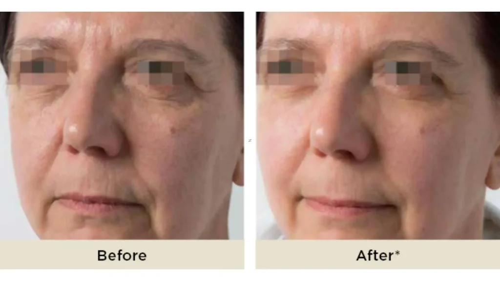 1-Real-World-Performance-and-Patient-Satisfaction-1024x576