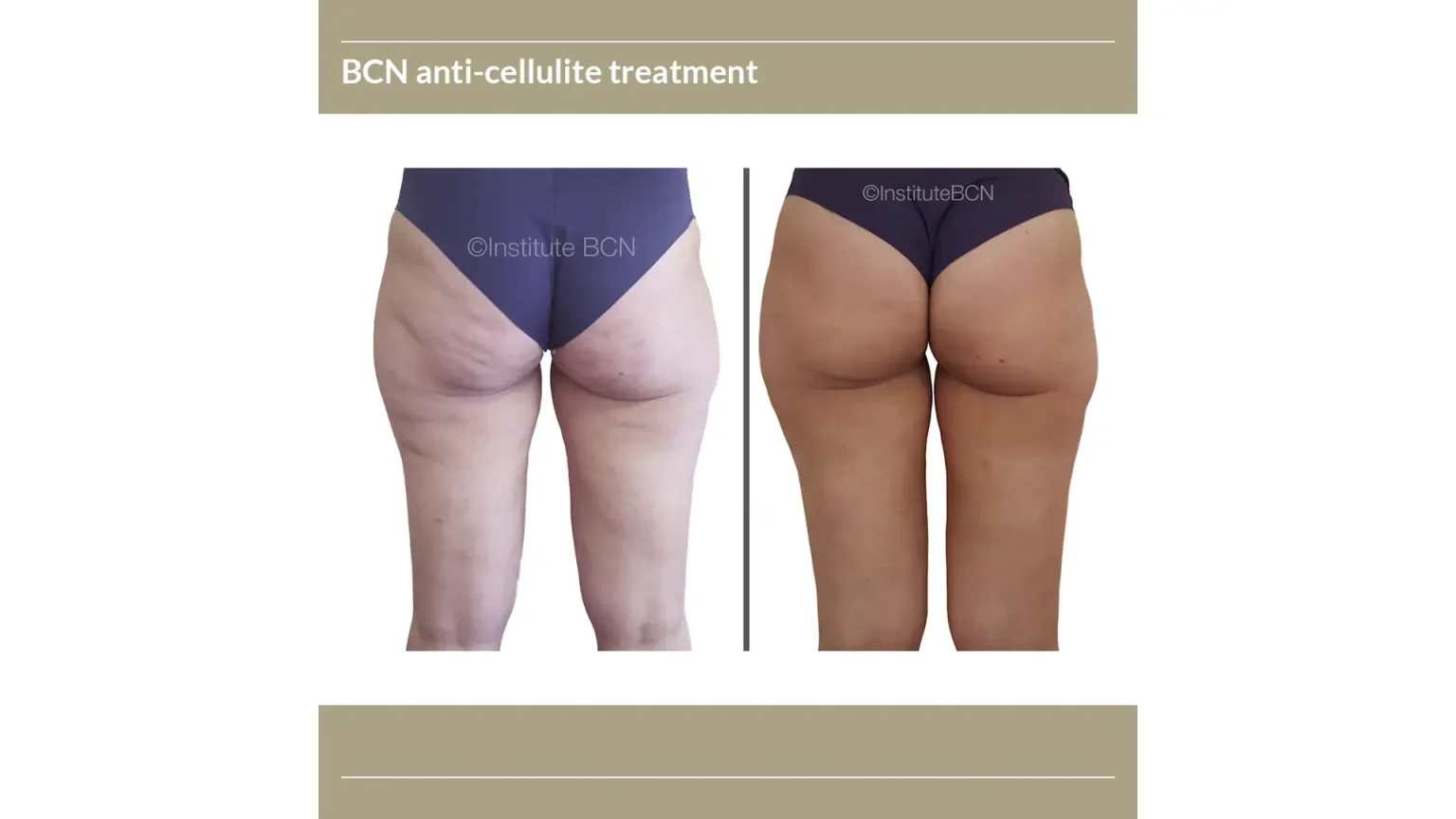 2-Advancing-Cosmetic-Treatments-with-Institute-BCN-Mesotherapy-Products-1536x864