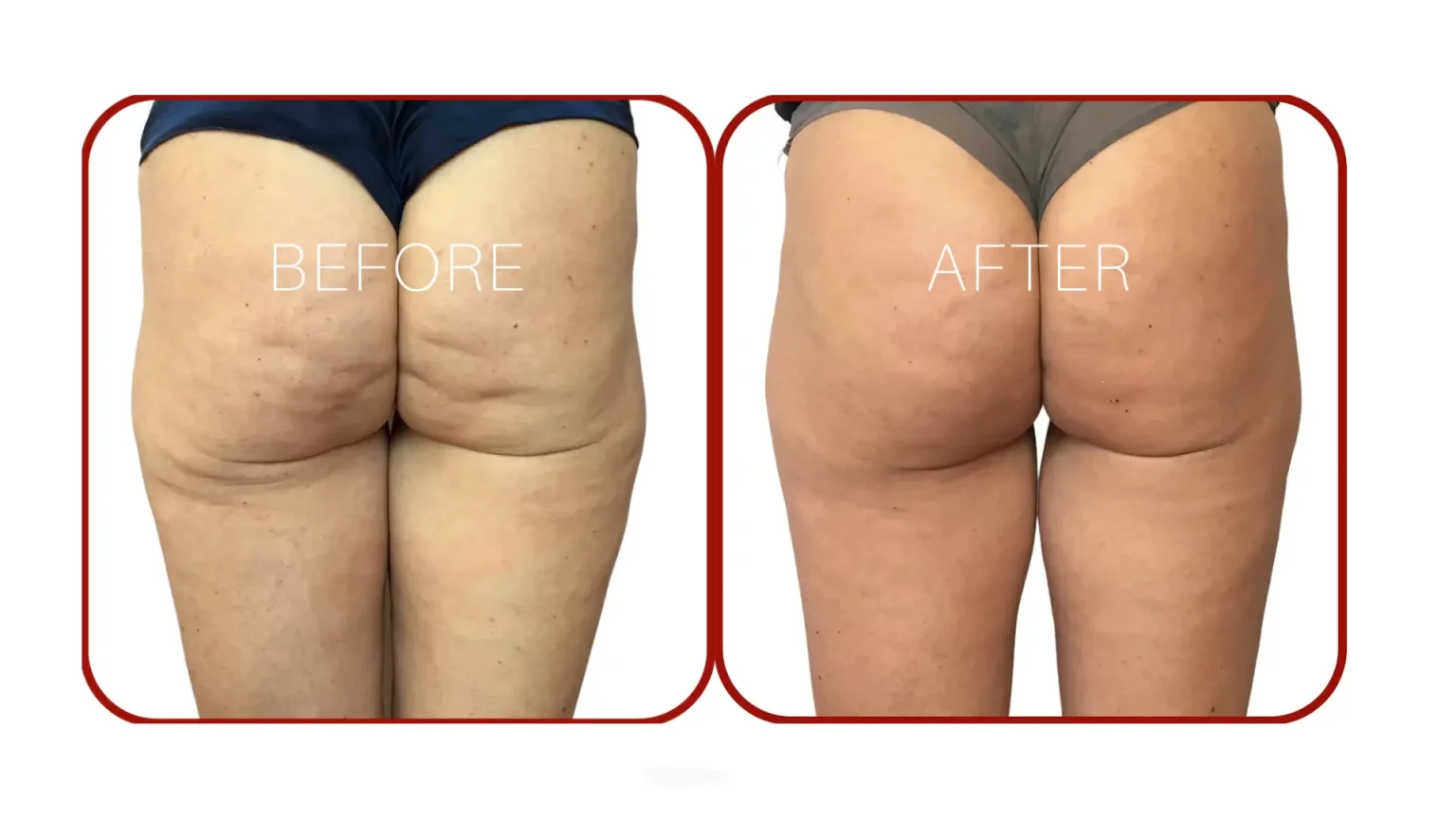 2-Real-World-Examples-of-Alidya-Before-and-After-Photos-1536x864 (1)