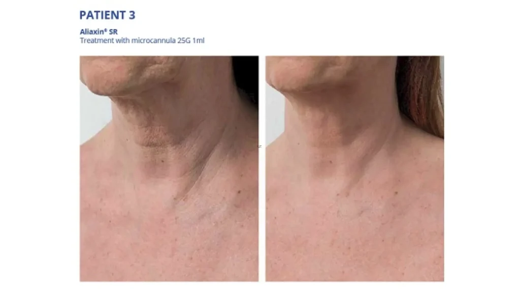 3-Real-World-Performance-and-Patient-Satisfaction-1024x576