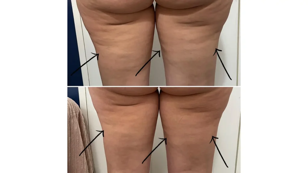 3-Showcasing-Alidya-Before-and-After-Photos-1024x576