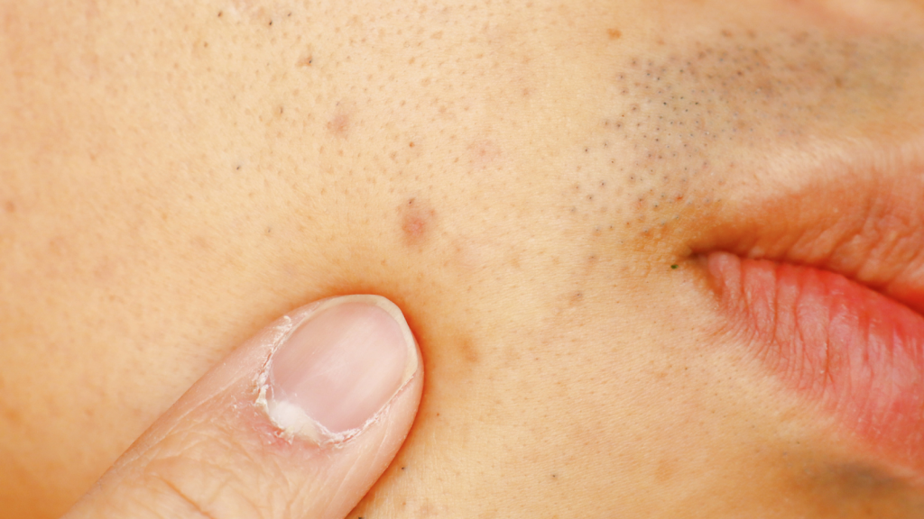 image-34-1024x576